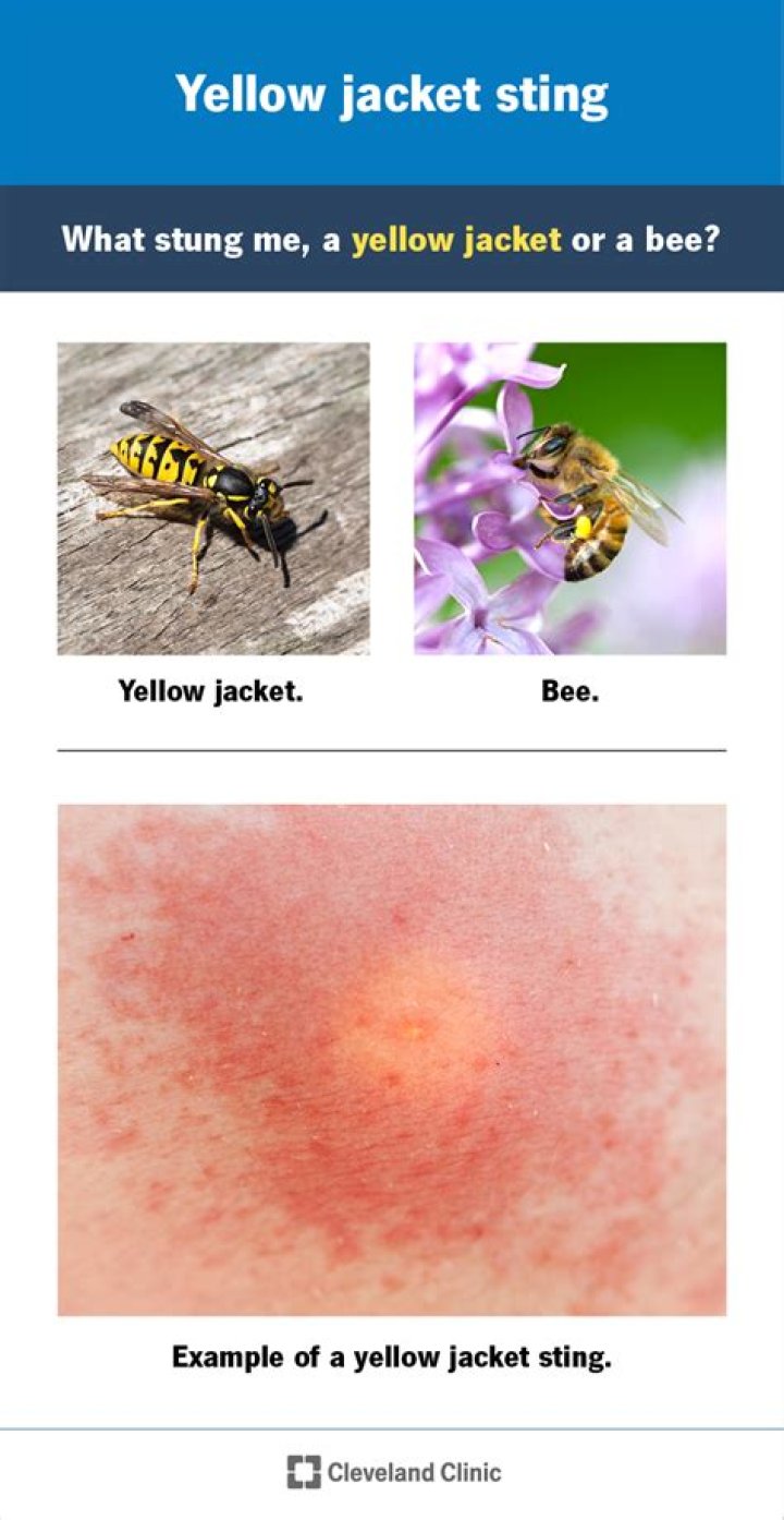 Will a bee sting me for no reason?
