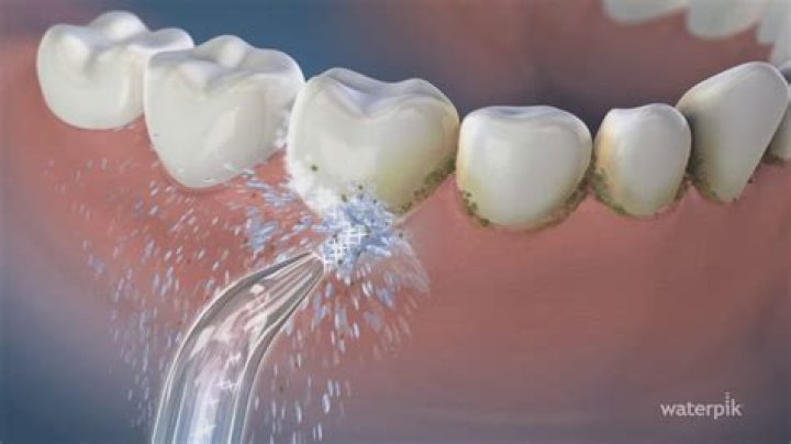 Will a Waterpik help with periodontal disease?