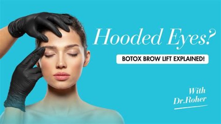 Will Botox lift hooded eyes?