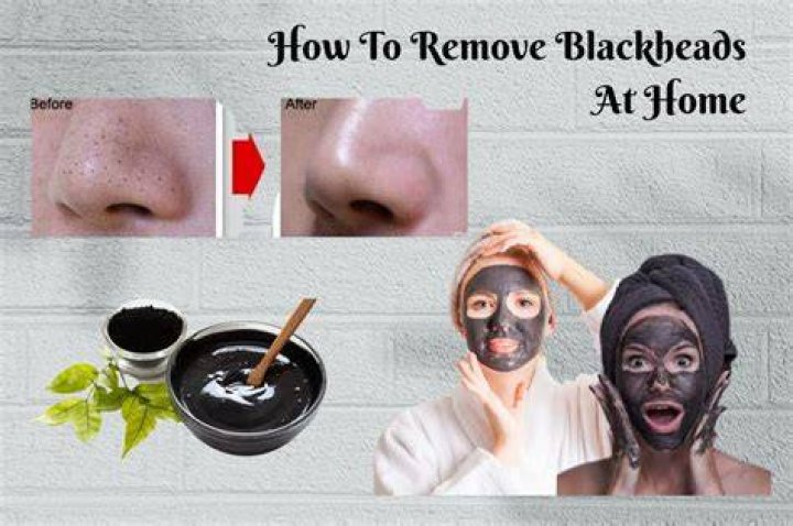 Will Epsom salt draw out blackheads?